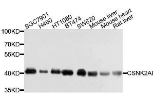 Western blot analysis of extracts of various cell lines, using CSNK2A1 antibody. (CSNK2A1/CK II alpha anticorps  (AA 1-391))