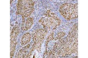 IHC analysis of CUX1 using anti-CUX1 antibody (ABIN7599103).