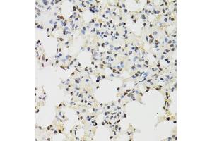Immunohistochemistry of paraffin-embedded mouse lung using KDM4A antibody. (KDM4A anticorps)