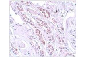 Immunohistochemistry of TCTN1 in human kidney tissue with TCTN1 antibody at 5 μg/ml.