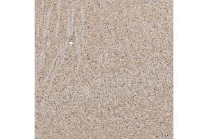 IHC analysis of SLC20A1 using anti-SLC20A1 antibody (ABIN7602463).