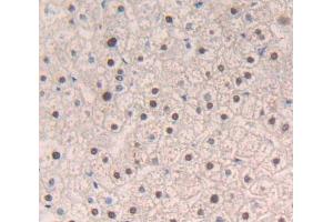 IHC-P analysis of Human Tissue, with DAB staining. (NR1H3 anticorps  (AA 95-434))
