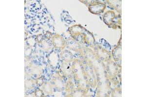 Immunohistochemistry of paraffin-embedded rat kidney using TGM5 antibody. (Transglutaminase 5 anticorps  (AA 461-720))