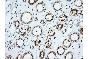 Immunohistochemical staining of paraffin-embedded Human thyroid tissue using anti-TTC32 mouse monoclonal antibody. (TTC32 anticorps)