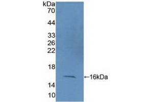 Detection of Recombinant CF6, Human using Polyclonal Antibody to Coupling Factor 6 (CF6)