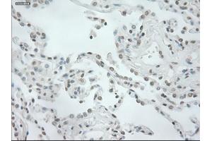 Immunohistochemical staining of paraffin-embedded prostate tissue using anti-NEUROG1mouse monoclonal antibody. (Neurogenin 1 anticorps)