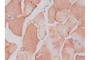 Detection of SIGIRR in Rat Skeletal muscle Tissue using Polyclonal Antibody to Single Ig IL1 Related Receptor (SIGIRR)