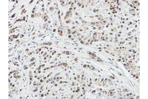 IHC-P Image Immunohistochemical analysis of paraffin-embedded A549 xenograft, using DUSP10, antibody at 1:100 dilution.