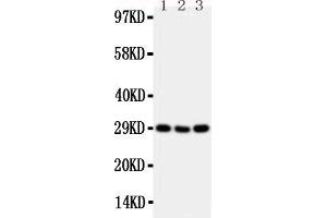 Anti-CD134/OX40 antibody, Western blotting Lane 1: Mouse Brain Tissue Lysate Lane 2: Mouse Spleen Tissue Lysate Lane 3: Mouse Liver Tissue Lysate