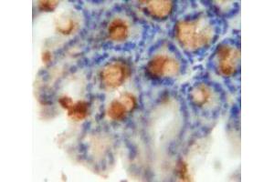 Used in DAB staining on fromalin fixed paraffin-embedded Intestine tissue (Emilin1 anticorps  (AA 806-1016))