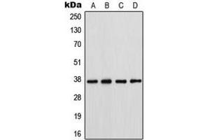 Western blot analysis of Connexin 37 expression in HeLa (A), SW620 (B), A431 (C), NIH3T3 (D) whole cell lysates. (GJA4 anticorps  (Center))