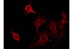 ABIN6275925 staining Hela by IF/ICC. (CLPTM1 anticorps  (Internal Region))