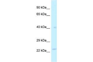 WB Suggested Anti-MRPL40 Antibody Titration: 1. (MRPL40 anticorps  (Middle Region))