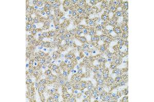 Immunohistochemistry of paraffin-embedded rat liver using MTTP antibody (ABIN5970876) at dilution of 1/100 (40x lens). (MTTP anticorps)