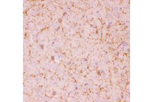 Anti-SIRT2 Picoband antibody,  IHC(P): Rat Brain Tissue