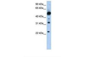Image no. 1 for anti-Transmembrane Protein 38B (TMEM38B) (C-Term) antibody (ABIN6738352) (TMEM38B anticorps  (C-Term))