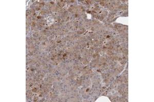Immunohistochemical staining of human pancreas with ANKRD44 polyclonal antibody  shows moderate cytoplasmic positivity in exocrine cells. (ANKRD44 anticorps)