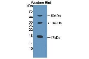 Western Blotting (WB) image for anti-Collagen, Type X (COL10) antibody (Biotin) (ABIN1175583)
