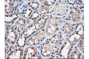 Immunohistochemical staining of paraffin-embedded Human prostate tissue using anti-PFN1 mouse monoclonal antibody. (PFN1 anticorps)