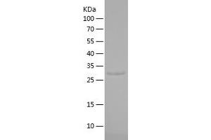 Western Blotting (WB) image for Solute Carrier Family 30 (Zinc Transporter), Member 8 (SLC30A8) (AA 1-79) protein (His-IF2DI Tag) (ABIN7125163)