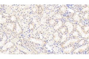 Detection of CPA1 in Rat Kidney Tissue using Polyclonal Antibody to Carboxypeptidase A1, Pancreatic (CPA1)