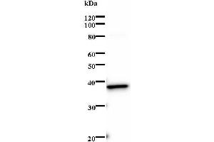 Western Blotting (WB) image for anti-SRY (Sex Determining Region Y)-Box 4 (SOX4) antibody (ABIN932199)