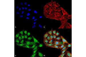 Immunocytochemistry/Immunofluorescence analysis using Rabbit Anti-WIPI2 Polyclonal Antibody . (WIPI2 anticorps  (C-Term) (Atto 488))