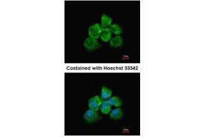 ICC/IF Image Immunofluorescence analysis of methanol-fixed A431, using ARHGEF18, antibody at 1:200 dilution. (ARHGEF18 anticorps  (Center))