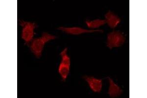 ABIN6276687 staining HUVEC by IF/ICC. (FSHR anticorps  (Internal Region))