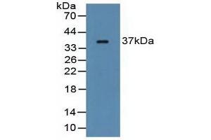 Detection of FCN1 in Rat Serum using Polyclonal Antibody to Ficolin 1 (FCN1) (FCN1 anticorps  (AA 25-279))