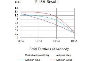 Black line: Control Antigen (100 ng),Purple line: Antigen (10 ng), Blue line: Antigen (50 ng), Red line:Antigen (100 ng)