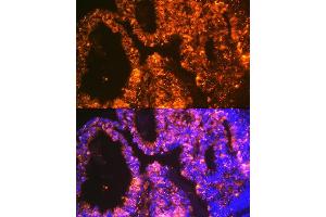 Immunofluorescence analysis of human ovary using Lin28 Rabbit mAb (ABIN7268266) at dilution of 1:100 (40x lens).