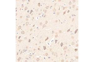 Immunohistochemistry analysis of paraffin-embedded rat brain using,Girdin (ABIN7073539) at dilution of 1: 1500 (Girdin anticorps)