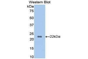 Western Blotting (WB) image for anti-Hemoglobin beta (HBB) (AA 1-147) antibody (ABIN1175987) (Hemoglobin Subunit beta anticorps  (AA 1-147))