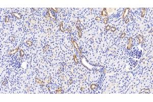 Detection of NOG in Human Kidney Tissue using Polyclonal Antibody to Noggin (NOG)