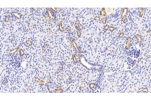 Detection of NOG in Human Kidney Tissue using Polyclonal Antibody to Noggin (NOG) (NOG anticorps  (AA 28-232))