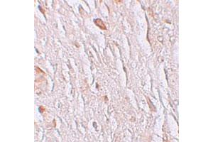 Immunohistochemical staining of human brain cells with SLC39A7 polyclonal antibody  at 2. (SLC39A7 anticorps  (N-Term))