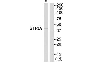 Western blot analysis of extracts from Jurkat cells, using GTF3A antibody. (GTF3A anticorps  (Internal Region))
