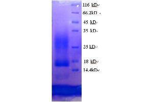 SDS-PAGE (SDS) image for CD59 (CD59) (AA 26-102) protein (His tag) (ABIN5713336)