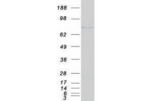 Validation with Western Blot