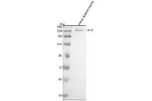 Western blot analysis of Dysferlin using anti-Dysferlin antibody (ABIN7604693).