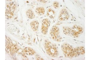 Immunohistochemistry (IHC) image for anti-Eukaryotic Translation Initiation Factor 2A, 65kDa (EIF2A) (AA 525-575) antibody (ABIN7453862) (EIF2A anticorps  (AA 525-575))