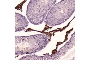 IHC testing of FFPE mouse testis tissue with Cyp17a1 antibody at 2ug/ml. (CYP17A1 anticorps  (AA 80-363))