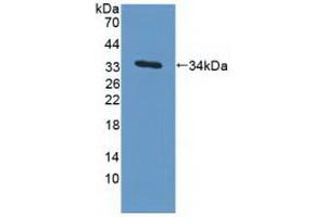 Detection of Recombinant MAPRE1, Human using Polyclonal Antibody to Microtubule Associated Protein RP/EB Family, Member 1 (MAPRE1) (MAPRE1 anticorps  (AA 2-268))