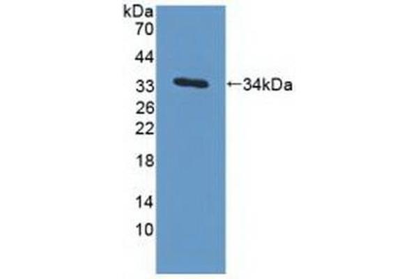 MAPRE1 anticorps  (AA 2-268)