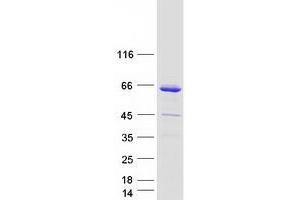 Validation with Western Blot