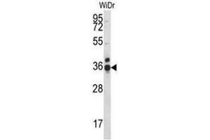 CCDC90B Antibody (Center) western blot analysis in WiDr cell line lysates (35µg/lane). (CCDC90B anticorps  (Middle Region))