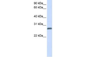 WB Suggested Anti-TMEM51 Antibody Titration:  0. (TMEM51 anticorps  (N-Term))