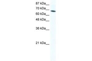 Western Blotting (WB) image for anti-DEAD (Asp-Glu-Ala-Asp) Box Polypeptide 1 (DDX1) antibody (ABIN2461580) (DDX1 anticorps)