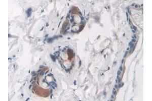 Detection of RAGE in Rat Skin Tissue using Polyclonal Antibody to Renal Tumor Antigen (RAGE)